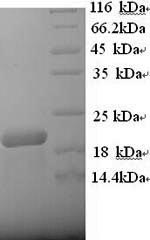 Greater than 90% as determined by SDS-PAGE.Recombinant Human B-Lymphocyte Antigen Cd20 (MS4A1) Protein (His)
