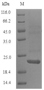Greater than 90% as determined by SDS-PAGE.Recombinant Mouse B-Lymphocyte Antigen Cd20 (MS4A1) Protein (His)