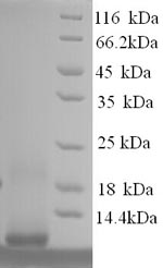 Greater than 90% as determined by SDS-PAGE.Recombinant Human Metallothionein-1F (MT1F) Protein (His)