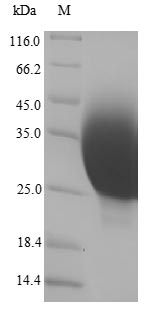 Greater than 90% as determined by SDS-PAGE.Recombinant Human Metallothionein-1X (MT1X) Protein (His)