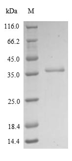 Greater than 90% as determined by SDS-PAGE.Recombinant Human Metallothionein-2 (MT2A) Protein (His)