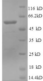 Greater than 90% as determined by SDS-PAGE.Recombinant Human Muscle, Skeletal Receptor Tyrosine-Protein Kinase (MUSK) Protein (His)