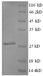Greater than 90% as determined by SDS-PAGE.Recombinant Rat Myosin-Binding Protein C, Cardiac-Type (MYBPC3) Protein (His)