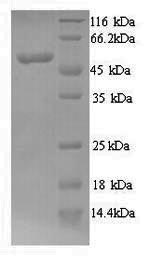 Greater than 90% as determined by SDS-PAGE.Recombinant Human N-Myc Proto-Oncogene Protein (MYCN) Protein (His)