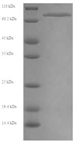 Greater than 90% as determined by SDS-PAGE.Recombinant Human Myosin-6 (MYH6) Protein (His)
