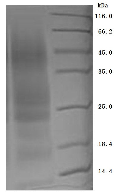 Greater than 95% as determined by SDS-PAGE.Recombinant Human Myosin Regulatory Light Polypeptide 9 (MYL9) Protein (His), Active