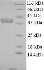 Greater than 90% as determined by SDS-PAGE.Recombinant Human Nicotinate Phosphoribosyltransferase (NAPRT) Protein (His)