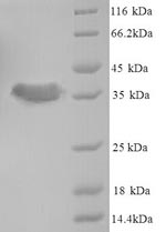 Greater than 90% as determined by SDS-PAGE.Recombinant Staphylococcus Aureus Acyl Carrier Protein (ACPP) Protein (GST)