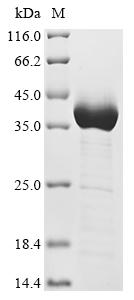 Greater than 85% as determined by SDS-PAGE.Recombinant Human Neurofilament Medium Polypeptide (NEFM) Protein (His)