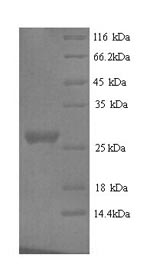 Greater than 90% as determined by SDS-PAGE.Recombinant Mouse Nidogen-1 (NID1) Protein (His)