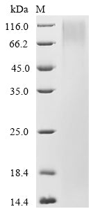 Greater than 90% as determined by SDS-PAGE.Recombinant Mouse Nidogen-2 (NID2) Protein (His)