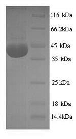 Greater than 90% as determined by SDS-PAGE.Recombinant Rat Nadph Oxidase 4 (NOX4) Protein (His)
