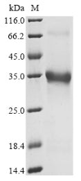 Greater than 85% as determined by SDS-PAGE.Recombinant Mouse Pro-Neuropeptide Y (NPY) Protein (hFc)