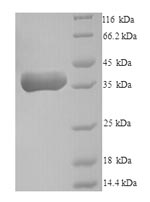 Greater than 90% as determined by SDS-PAGE.Recombinant Human Pro-Neuregulin-2, Membrane-Bound Isoform (NRG2) Protein (His)