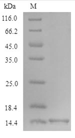 Greater than 90% as determined by SDS-PAGE.Recombinant Mouse Oncomodulin (OCM) Protein (His)
