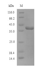 Greater than 90% as determined by SDS-PAGE.Recombinant Human N-Glycosylase/Dna Lyase (OGG1) Protein (His)