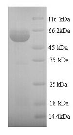 Greater than 90% as determined by SDS-PAGE.Recombinant Human Protein Disulfide-Isomerase (P4HB) Protein (His)