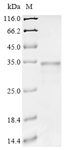 Greater than 90% as determined by SDS-PAGE.