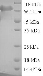 Greater than 90% as determined by SDS-PAGE.Recombinant Human Poly (PARN) Protein (His)