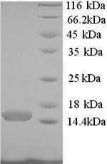 Greater than 90% as determined by SDS-PAGE.
