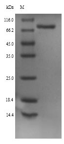 Greater than 90% as determined by SDS-PAGE.Recombinant Rat Neuroendocrine Convertase 1 (PCSK1) Protein (His)