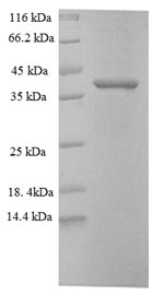 Greater than 90% as determined by SDS-PAGE.Recombinant Mouse Proprotein Convertase Subtilisin/Kexin Type 5 (PCSK5) Protein (His)