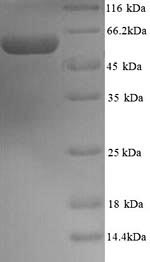 Greater than 90% as determined by SDS-PAGE.Recombinant Mouse Protein Disulfide-Isomerase A2 (PDIA2) Protein (His)