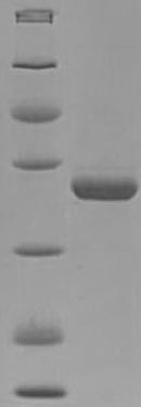 Greater than 90% as determined by SDS-PAGE.Recombinant Mouse Pyridoxal Phosphate Phosphatase (PDXP) Protein (His)