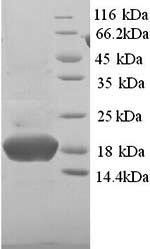 Greater than 90% as determined by SDS-PAGE.