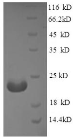 Greater than 90% as determined by SDS-PAGE.Recombinant Bovine Polymeric Immunoglobulin Receptor (PIGR) Protein (His)