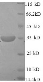 Greater than 90% as determined by SDS-PAGE.Recombinant Mouse Pituitary Homeobox 3 (PITX3) Protein (His)