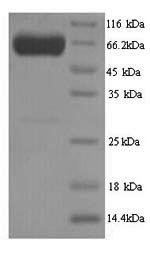 Greater than 90% as determined by SDS-PAGE.Recombinant Human Pyruvate Kinase Pklr (PKLR) Protein (His)