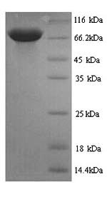 Greater than 90% as determined by SDS-PAGE.Recombinant Rat Pyruvate Kinase Pklr (PKLR) Protein (His)
