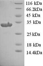 Greater than 90% as determined by SDS-PAGE.Recombinant Rat Urokinase Plasminogen Activator Surface Receptor (PLAUR) Protein (His)