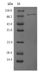 Greater than 90% as determined by SDS-PAGE.Recombinant Human Protein Phosphatase 1 Regulatory Subunit 15A (PPP1R15A) Protein (His)