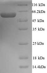 Greater than 90% as determined by SDS-PAGE.Recombinant Human Melanoma Antigen Preferentially Expressed In Tumors (PRAME) Protein (His)