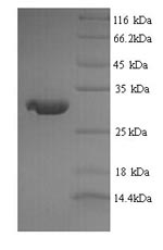 Greater than 90% as determined by SDS-PAGE.Recombinant Rat Major Prion Protein (PRNP) Protein (His)