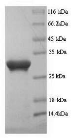 Greater than 90% as determined by SDS-PAGE.Recombinant Human Prominin-1 (PROM1) Protein (His)