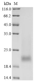 Greater than 90% as determined by SDS-PAGE.Recombinant Human Prostate Stem Cell Antigen (PSCA) Protein (His)
