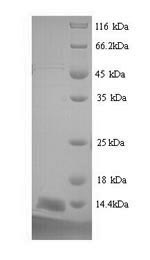 Greater than 90% as determined by SDS-PAGE.Recombinant Mouse Prostate Stem Cell Antigen (PSCA) Protein (His)