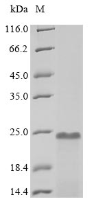 Greater than 85% as determined by SDS-PAGE.Recombinant Human Prothymosin Alpha (PTMA) Protein (His)