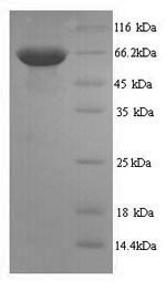 Greater than 90% as determined by SDS-PAGE.Recombinant Human Receptor-Type Tyrosine-Protein Phosphatase C (PTPRC) Protein (His)