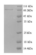 Greater than 90% as determined by SDS-PAGE.Recombinant Mouse Receptor-Type Tyrosine-Protein Phosphatase N2 (PTPRN2) Protein (His)