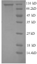 Greater than 90% as determined by SDS-PAGE.Recombinant Human Glycogen Phosphorylase, Liver Form (PYGL) Protein (His)