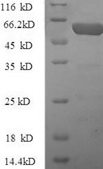 Greater than 90% as determined by SDS-PAGE.Recombinant Human Pregnancy Zone Protein (PZP) Protein (GST)