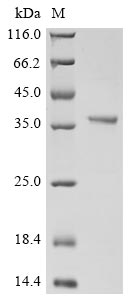 Greater than 90% as determined by SDS-PAGE.Recombinant Human Glutaminyl-Peptide Cyclotransferase (QPCT) Protein (His)