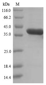Greater than 90% as determined by SDS-PAGE.Recombinant Mouse Glutaminyl-Peptide Cyclotransferase (QPCT) Protein (His)