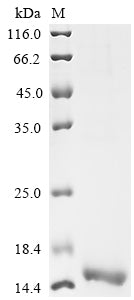 Greater than 90% as determined by SDS-PAGE.Recombinant Human Ras-Related Protein Rab-10 (RAB10) Protein (His)