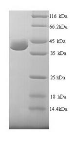 Greater than 90% as determined by SDS-PAGE.Recombinant Human Uv Excision Repair Protein Rad23 Homolog A (RAD23A) Protein (His)