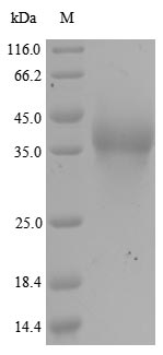 Greater than 90% as determined by SDS-PAGE.Recombinant Human E3 Sumo-Protein Ligase Ranbp2 (RANBP2) Protein (His)
